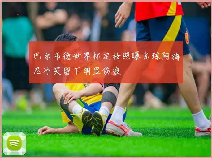 巴尔韦德世界杯定妆照曝光琼阿梅尼冲突留下明显伤痕